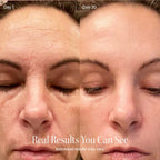 4-in-1 Radiant Renewal Skincare Wand